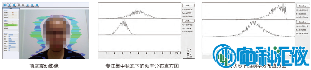 心理健康狀態(tài)檢測(cè).png